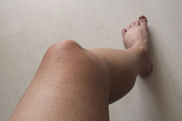 Обезкосмяване на краченца